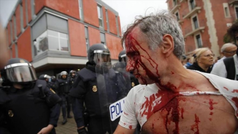 Mas de mil catalanes heridos reprimidos por la policia española.