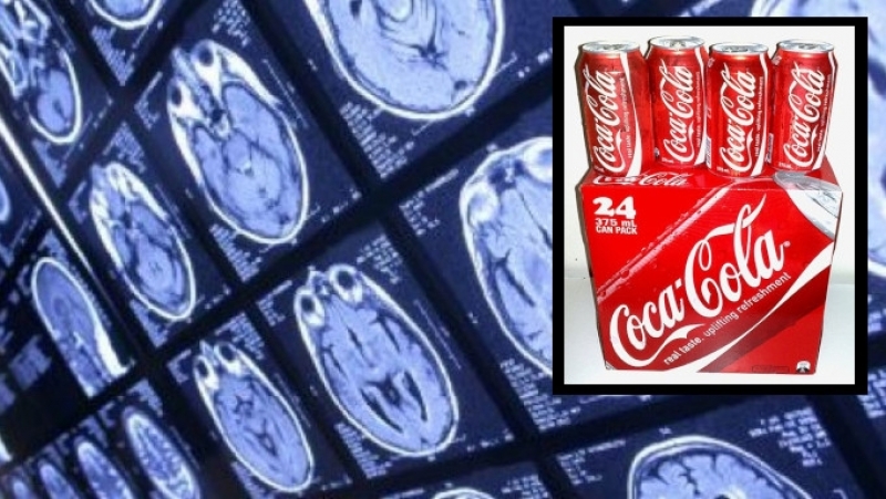 Cocacola provoca desde depresión hasta Alzheimer: Investigadora de la UNAM