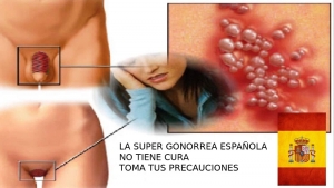 Tener sexo con españoles te puede contagiar de Super Gonorrea